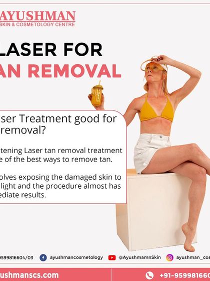 Don't let an unwanted tan dull your skin. Our laser tan removal treatment is a fast and effective way to remove sun damage and restore your skin's natural, bright tone with immediate results.