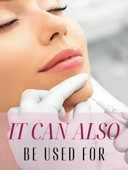 This image shows a chin filler procedure. This treatment is excellent for improving facial profile and harmony by adding definition and projection to the chin area.