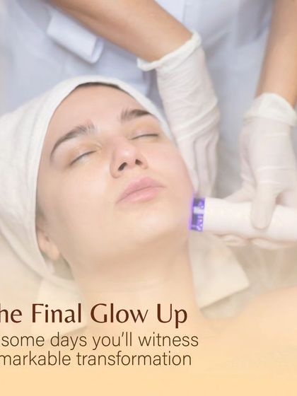 The final glow up. In the days following your Dermafrac treatment, you will witness a remarkable transformation as your skin becomes smoother, firmer, and visibly more radiant.