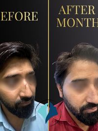 Reconstructive & Scar Revision Surgery