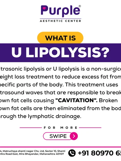 Wondering what U-Lipolysis is? It's a non-surgical weight loss treatment that uses ultrasound waves to break down fat cells, which your body then naturally eliminates.