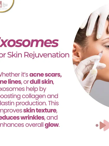 Exosomes are excellent for skin rejuvenation. Whether it's acne scars, fine lines, or dull skin, they work by boosting collagen and elastin production to improve texture and enhance your overall glow.