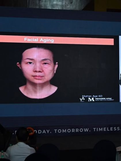 A slide from the international program demonstrating the effects of facial aging. Visuals like these are powerful tools for understanding the anatomical changes we aim to address with our treatments.