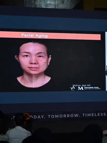 A slide from the international program demonstrating the effects of facial aging. Visuals like these are powerful tools for understanding the anatomical changes we aim to address with our treatments.