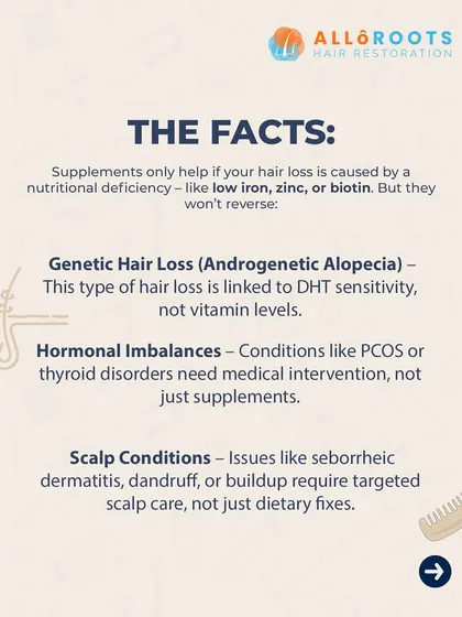 Here are the facts. Supplements only help if your hair loss is caused by a specific nutritional deficiency. They will not reverse genetic hair loss, hormonal imbalances, or scalp conditions, which require targeted medical intervention.