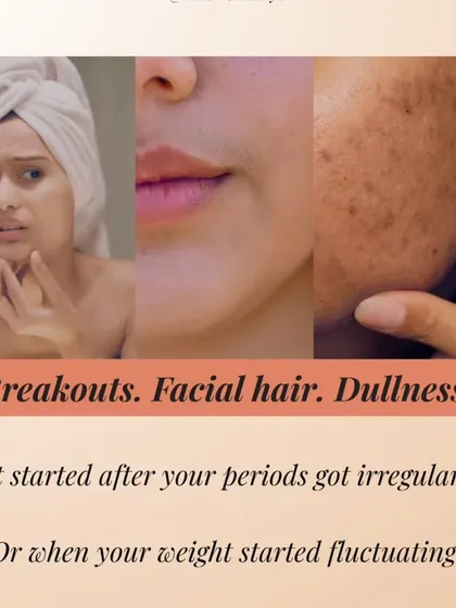 Breakouts, facial hair, dullness. Often, these skin changes are linked to hormonal shifts like irregular periods or weight fluctuations. I understand this connection and address it as part of your treatment plan.