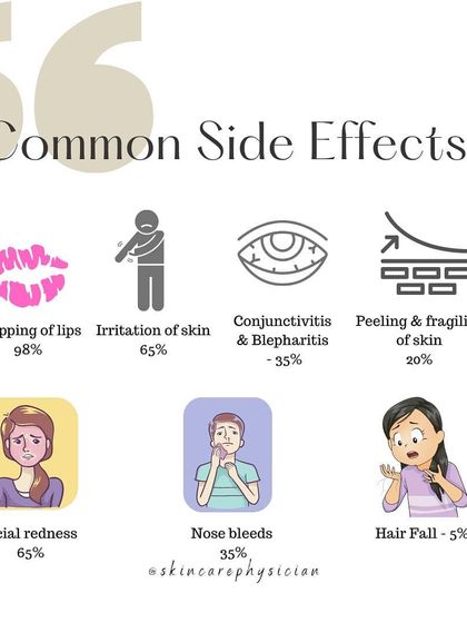 While highly effective, Isotretinoin has common side effects like chapped lips and dry skin. I monitor my patients closely to manage these effects throughout the treatment course.
