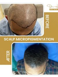 Hair Restoration & Treatment