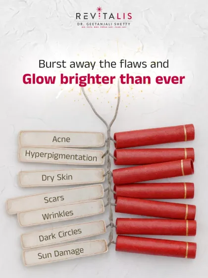 Burst Away the Flaws This Diwali. A festive post symbolizing the fight against various skin flaws like acne, hyperpigmentation, scars, and sun damage, wishing everyone a radiant and clear celebration.