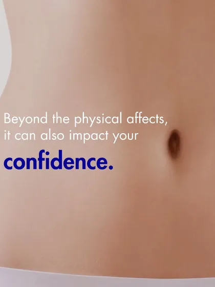Beyond the physical effects, post-pregnancy body changes can also impact your confidence. It's important to acknowledge this and know that there are solutions available.