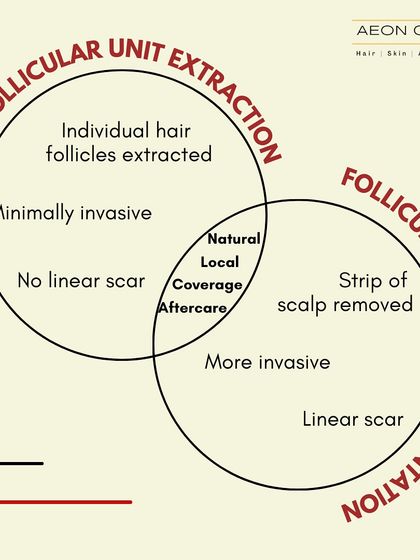This Venn diagram explains the difference between FUE (Follicular Unit Extraction) and FUT (Follicular Unit Transplantation). We specialize in the minimally invasive FUE technique, which leaves no linear scar.
