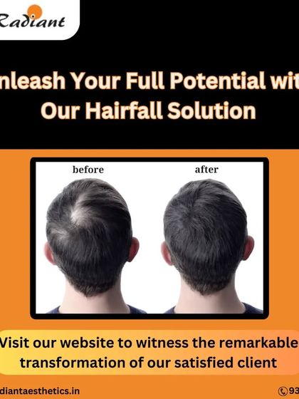 Don't let hair fall hold you back. This before-and-after of a crown area restoration shows the remarkable transformations that are possible with our advanced hairfall solutions.