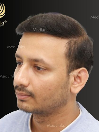 A different angle of the final result, highlighting the excellent density.