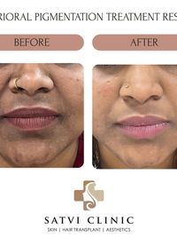 Dermatology Consultation