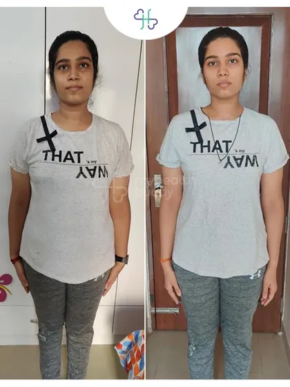 Front view of Torsha's 4kg loss, showing what's possible in a short time with the right guidance.