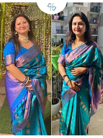 A beautiful comparison of Rashmi enjoying an event, feeling more confident and healthy after her 15 kg weight loss. Fitness is about enjoying your life to the fullest.