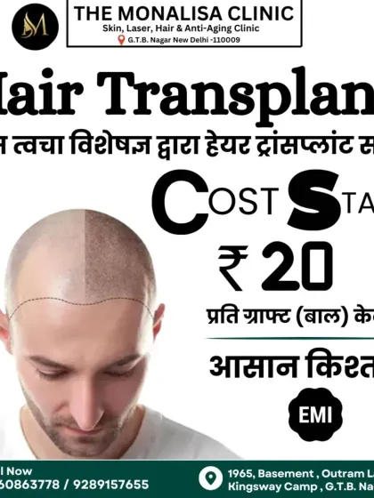 Our hair transplant surgery is performed by skin specialists from AIIMS, ensuring the highest standard of medical care. We offer easy EMI options to help you manage the cost.