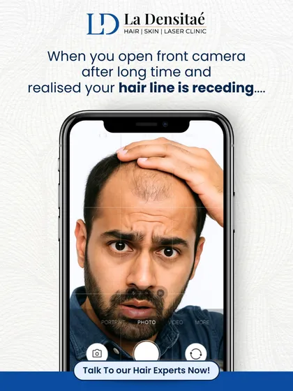 The front camera doesn't lie, but a receding hairline doesn't have to be permanent. This relatable meme serves as a reminder that expert hair restoration can help you take the first step toward confidence.