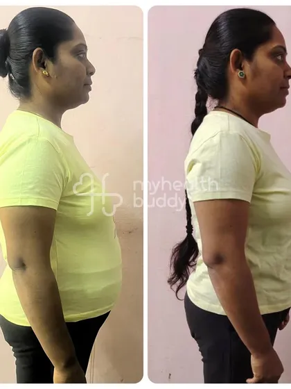Rekha lost 9 kgs in 3 months. Her side profile shows a significant change, which she achieved after trying gym and yoga without success before finding the right nutritional guidance.