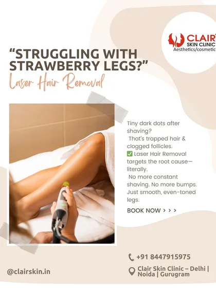 If you're struggling with "strawberry legs" or tiny dark dots after shaving, you are not alone. Our laser hair removal targets the root cause by treating trapped hair and clogged follicles for smooth, even-toned legs.