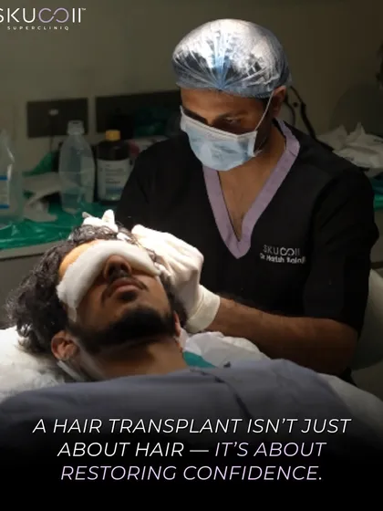 A hair transplant is a meticulous surgical procedure that restores not just hair, but confidence. This image captures our surgeon during an FUE transplant, focusing on creating a natural-looking hairline for a permanent solution to hair loss.