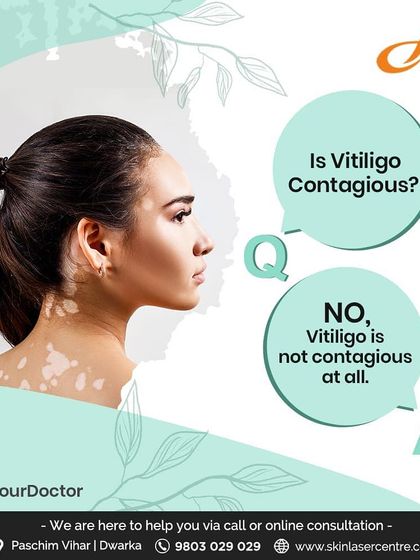 I am often asked if vitiligo is contagious. The answer is simple: no, it is not contagious at all. It is an autoimmune condition, not an infection, and it cannot be spread through any form of contact.