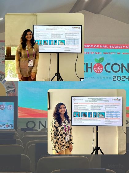 Presenting my work on nail disorders at Onychocon 2024. It's always rewarding to share findings with peers who are passionate about the same subjects.