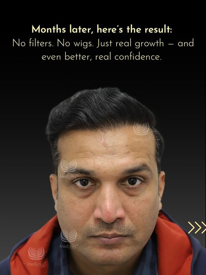 Months later, the result is real growth and, more importantly, real confidence. No filters, no wigs, just results.