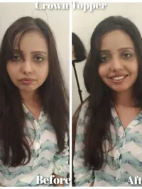 Crown & Scalp Toppers
