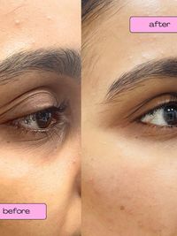 Cosmetic Dermatology