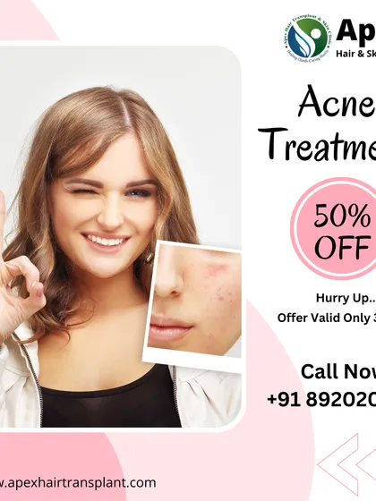 Don't let acne control your confidence. We offer dermatologist-led acne treatments that are non-invasive and designed to deliver clear results. This image highlights the transformative effect of our targeted solutions, helping you move towards blemish-free skin.