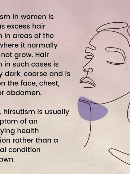 An explanation of hirsutism as a symptom of hormonal imbalance in women.