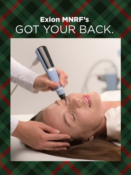 For those late nights and stressful days, Exion MNRF has your back. This image shows the treatment being performed, highlighting its role in rejuvenating tired skin and ensuring you always look your best, no matter what life throws at you.