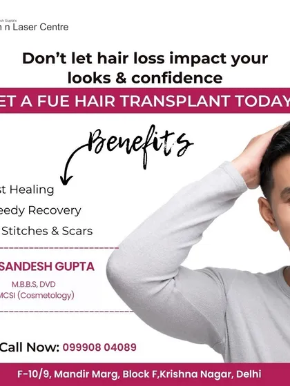 The benefits of FUE hair transplant are clear: fast healing, speedy recovery, and no stitches or scars. It is the modern solution for anyone looking to permanently address hair loss.