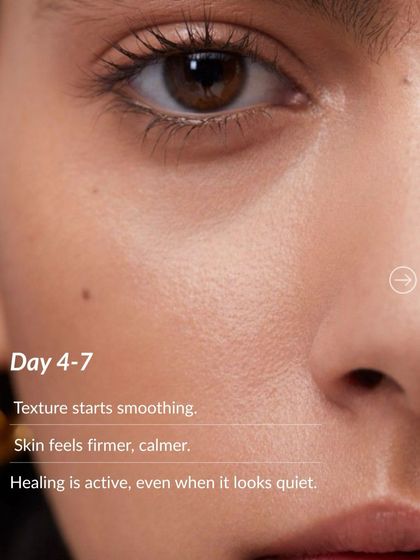 Day 4-7 after microneedling: You'll start to notice your skin's texture smoothing out. It will feel firmer and calmer as the healing continues, even when it looks quiet on the surface.