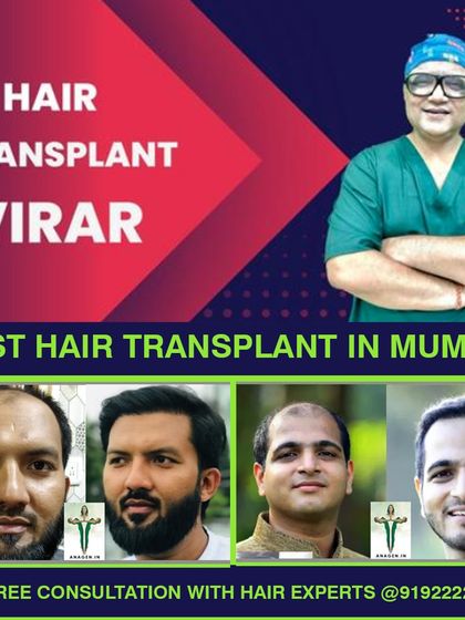 Residents of Virar can access our high density Biotech Instant FUE procedures. This graphic showcases the excellent hairline design and scar free results we provide to our Mumbai based clients.