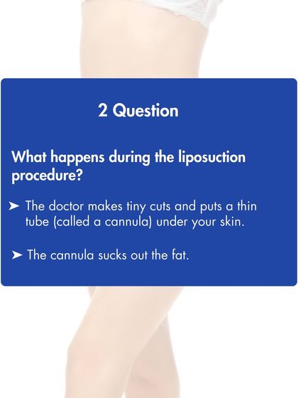 During a liposuction procedure, we make tiny incisions and insert a thin tube called a cannula. This device is used to gently suction out the targeted fat cells from beneath the skin.