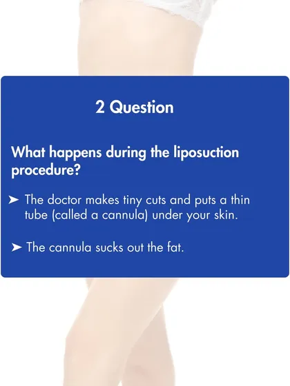 During a liposuction procedure, we make tiny incisions and insert a thin tube called a cannula. This device is used to gently suction out the targeted fat cells from beneath the skin.