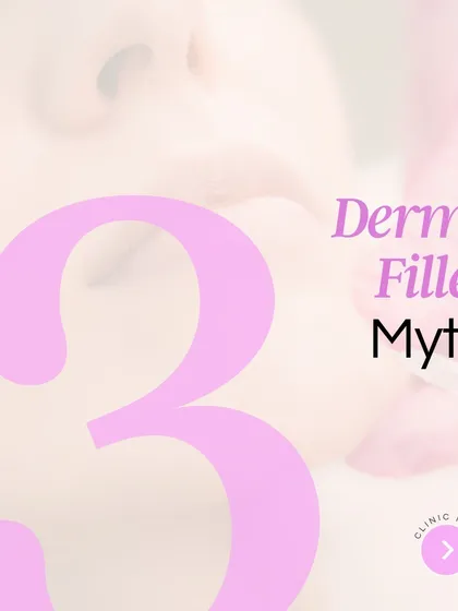 We're here to bust some of the biggest myths about dermal fillers. Many people fear they will look fake, stretch their skin, or that the results are permanent. We explain how, in the hands of a skilled injector, fillers provide natural-looking volume and can be safely reversed if needed.