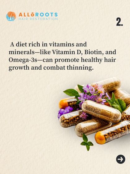 A diet rich in vitamins and minerals like Vitamin D, Biotin, and Omega-3s can promote healthy hair growth and help combat thinning from the inside out.