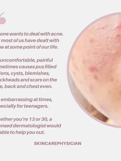 Acne can be uncomfortable and affect your confidence at any age. As a licensed dermatologist, I am here to help you navigate this journey, whether you are 13 or 30.