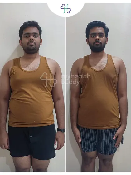 A front view of Gowtham's 12 kg weight loss. He became a fitness ambassador for his friends and family after experiencing his own transformation.