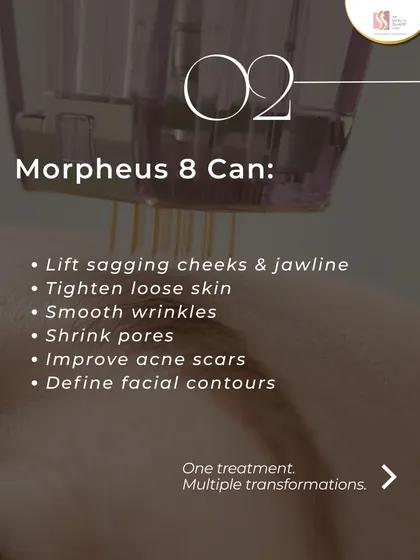 Morpheus8 is a true multi-tasker. This single treatment addresses many common concerns by combining microneedling with radiofrequency. It lifts sagging cheeks, smooths wrinkles, shrinks pores, and even improves acne scars by remodeling the skin from within.