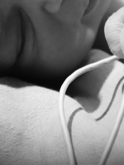 An artistic close-up from a birth photography session, focusing on the baby's profile and the medical equipment that is part of their entry into the world.