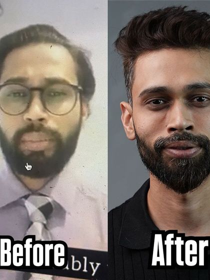 My own facial transformation from fat loss, showing how getting leaner enhances facial features and creates a more youthful appearance.