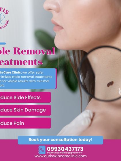 We offer safe, scar-minimized mole removal treatments designed for visible results with minimal discomfort. Our procedures focus on reducing side effects, skin damage, and pain under expert dermatological care.
