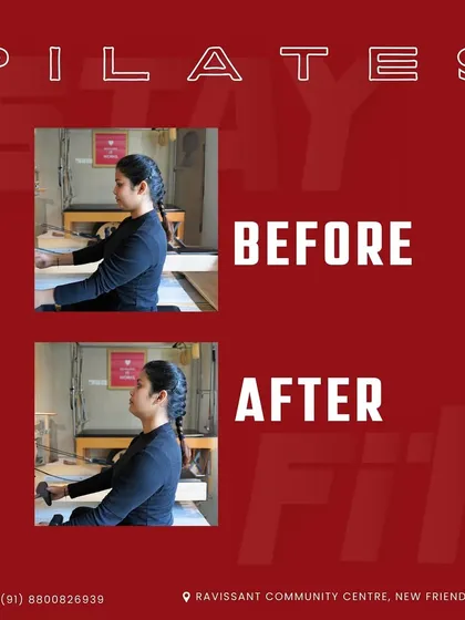 The results speak for themselves. This before and after shot shows a significant improvement in posture and spinal alignment after consistent Pilates sessions, highlighting a key benefit of the practice.