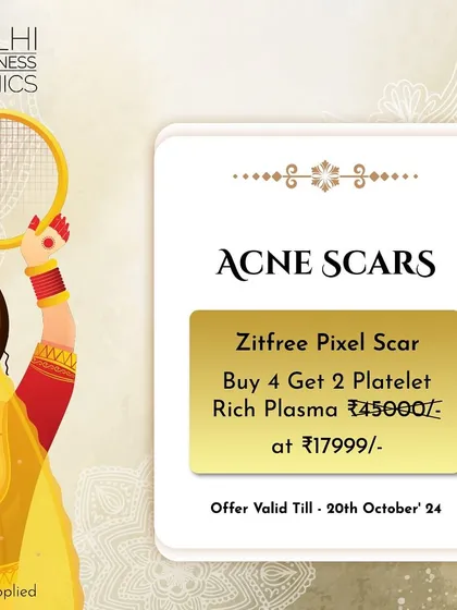 Our Karwa Chauth special offer for acne scars, combining Zitfree Pixel Scar treatment with complimentary Platelet Rich Plasma sessions.