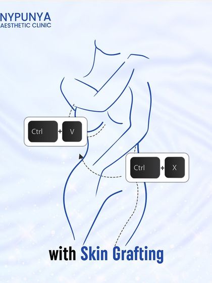 Ever wished you could cut and paste fat from one part of your body to another? With structural fat grafting, we can. We use your own fat to restore volume to the face for a natural, permanent, and youthful rejuvenation.