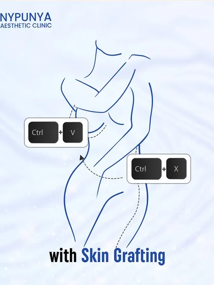 Structural fat grafting is like a natural "cut and paste" for your body. We can harvest your own fat from one area and transfer it to another, like the face, to restore lost volume for a youthful look.